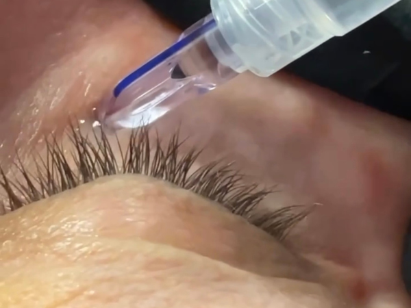 Eye Neck Treatment