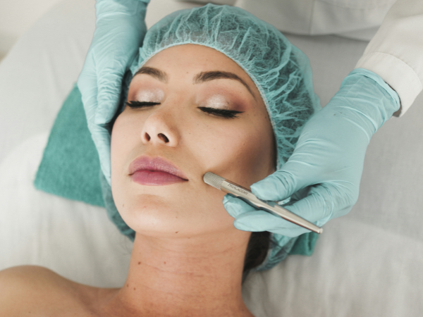 microneedling